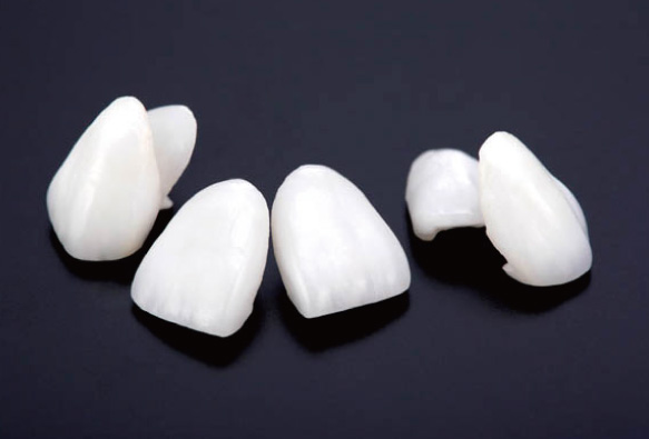 フルセラミッククラウン