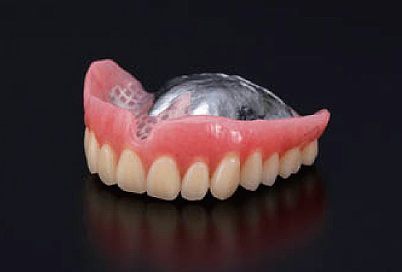 金属床義歯(総義歯)